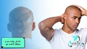 خارش و قرمزی پس از کاشت مو  علت و نحوه درمان